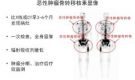 澳门威尼克斯人网站核医学科骨检查与治疗